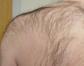 before image