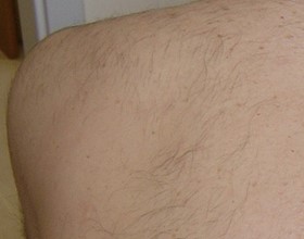 after image